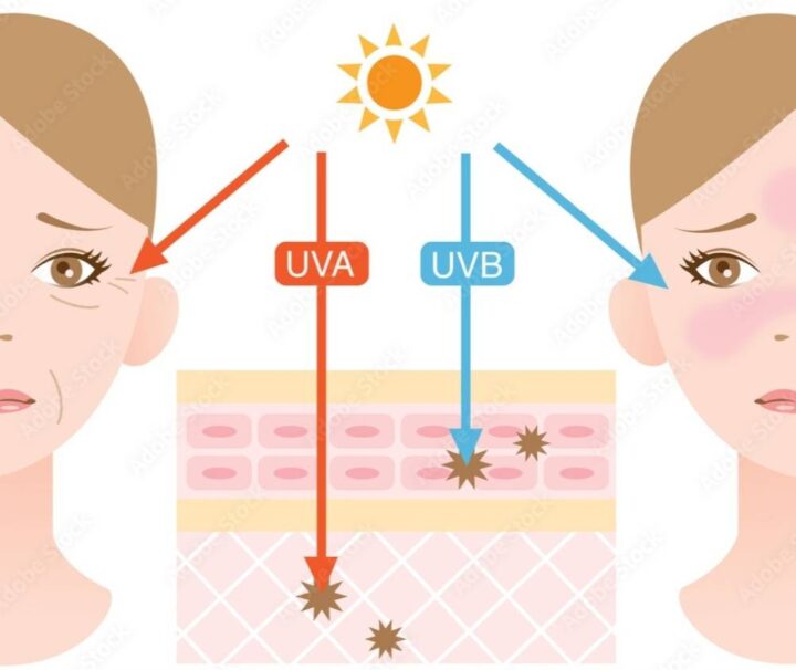 紫外線には種類がある？違いを知って対策しよう！の画像